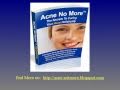 Antibiotics for acne