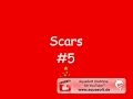 Ribery scars